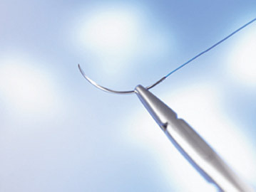 surgical-sutures-Market