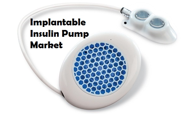 Implantable Insulin Pump