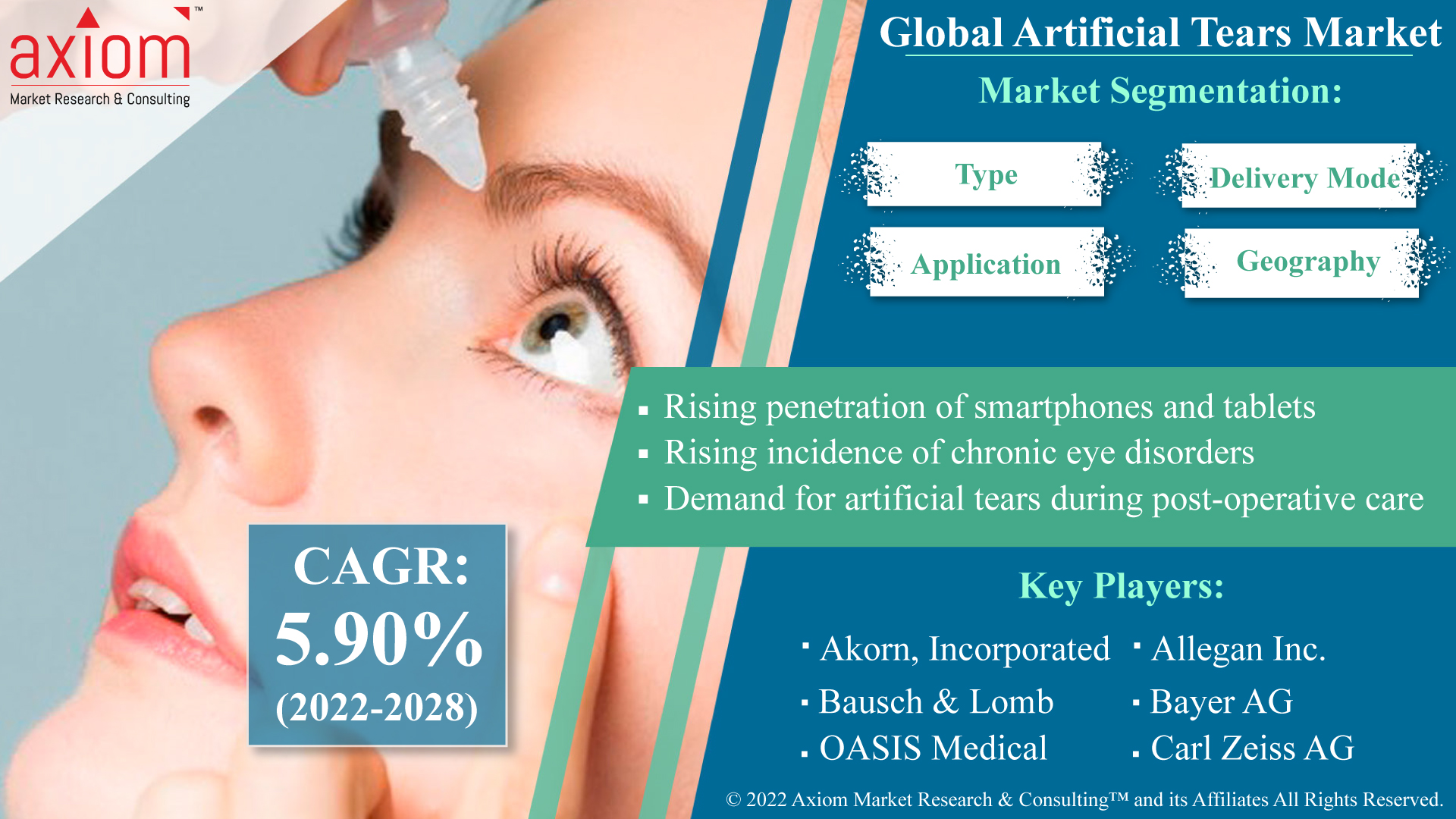 Global-Artificial-Tears-Market 